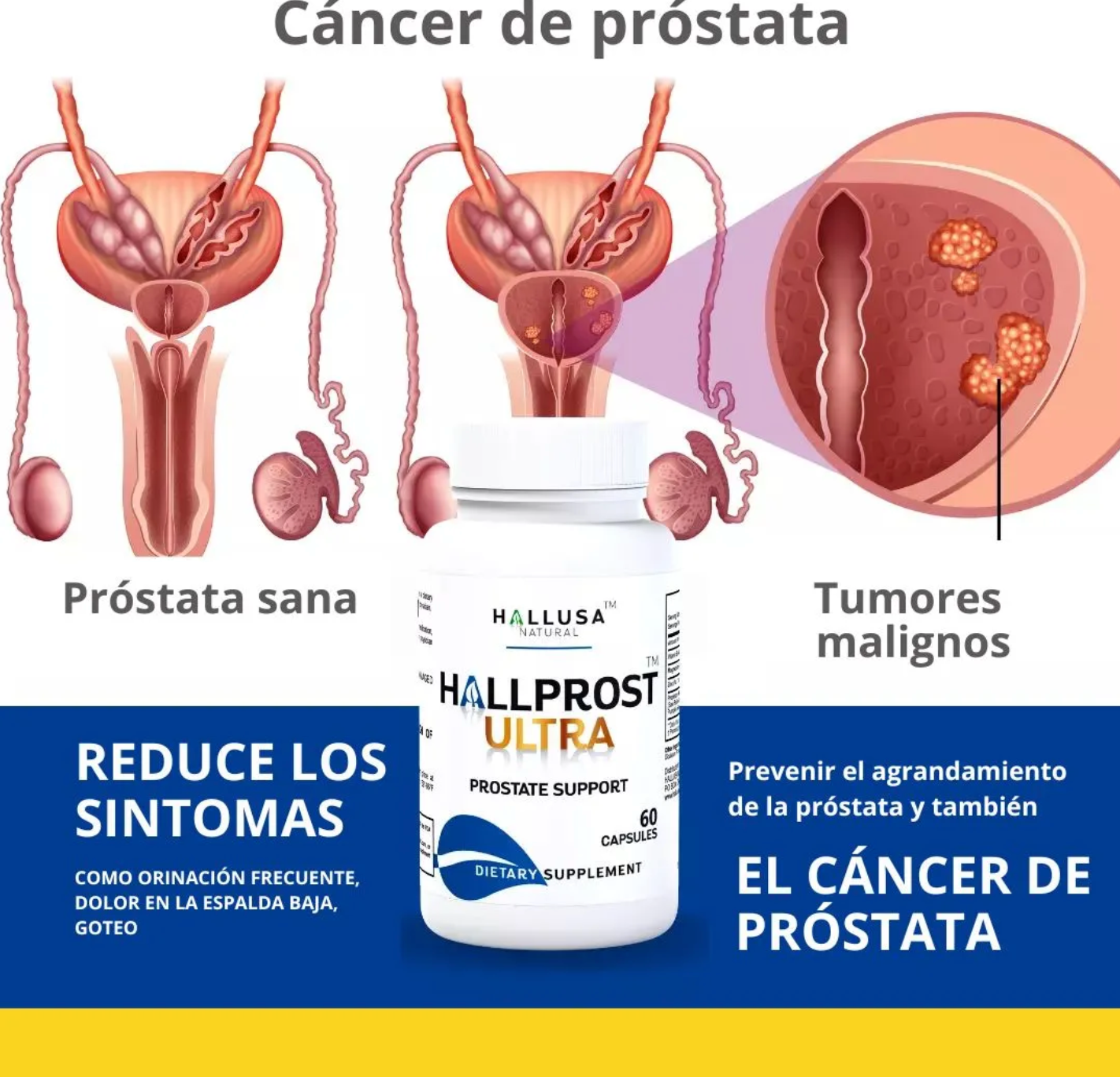 PROSTATA SANA+ENVIO GRATIS